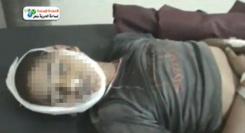 طفل قتل برصاص قوات صالح في تعز اليوم الجمعة 11-11-2011