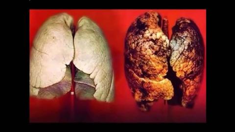 للمدخنين بشراهة .. 5 أطعمة تنظف الرئة من السموم