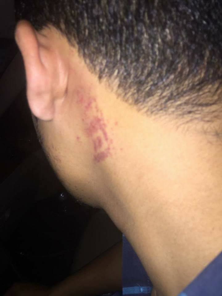 الحكومة اليمنية تدين تعرض أحد مواطنيها للضرب المبرح من ضابط سعودي في الرياض (صور)