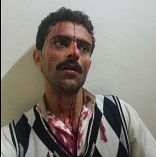 ناشط مقرب من صالح يتعرض للاختطاف والضرب المبرح من الحوثيين في صنعاء
