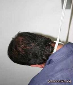 إنتحار سجين في إحدى حمامات السجن الاحتياطي بمحافظة إب 