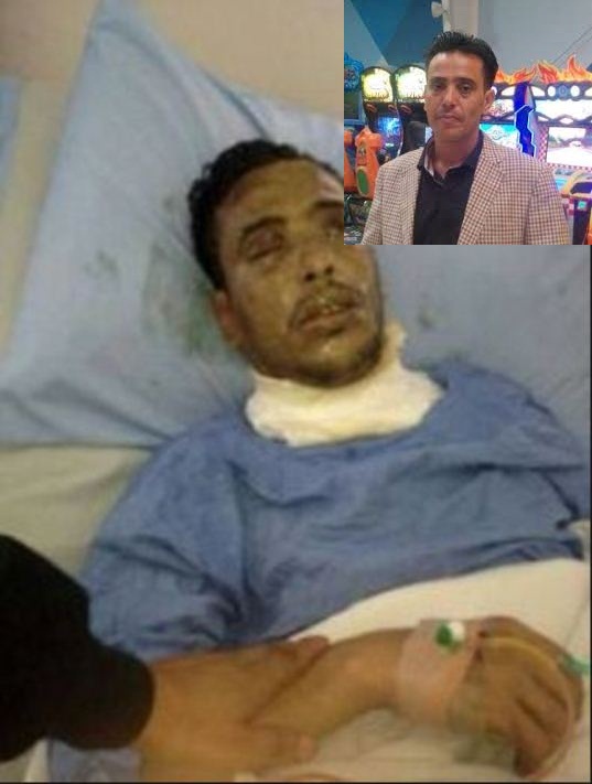 أمن مطار عدن يلقي القبض على أحمد النمر المتهم بالاعتداء على أحد موظفي وزارة الكهرباء بمادة الأسيد