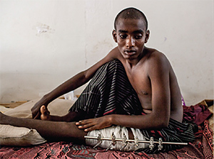 «رايتس ووتش» تطالب بالتحقيق في الإنتهاكات التي يتعرض لها المهاجرون الأفارقة بالمعتقلات اليمنية