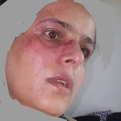الناشطة ابتسام أبو دنيا تكشف تفاصيل جديدة عن اعتداء قيادات حوثية عليها