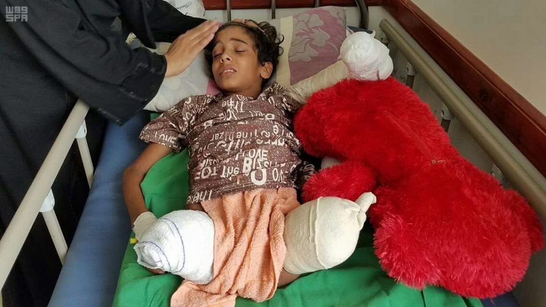 مركز الملك سلمان يبادر بعلاج طفل يمني بترت رجلاه ويده بعد مناشدة عاجلة من قبل مراسل قناة الجزيرة في تعز