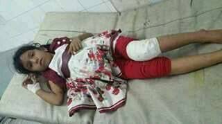 تعز: مقتل طفلة وإصابة خمسة أخرين في مجزرة جديدة للميليشيات في «بير باشا»