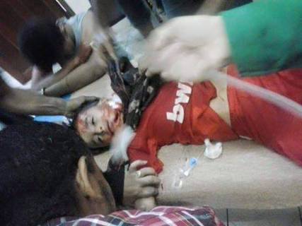 الحوثيون يقتلون الجرحى في عدن ويعدمون مدنيين